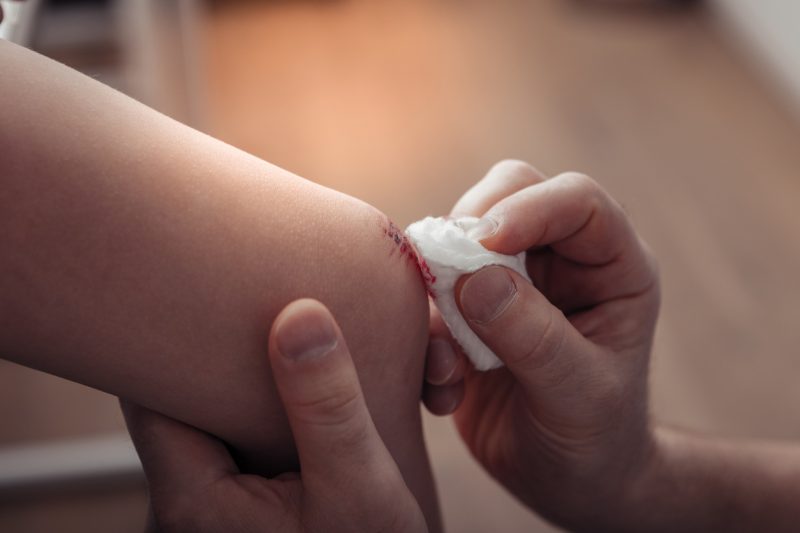 Rather than just making use of a plain cloth, which could be unsterilized, to wipe off blood, soak a cotton ball in a bottle of medicinal liquid and carefully clean whatever wound you have.