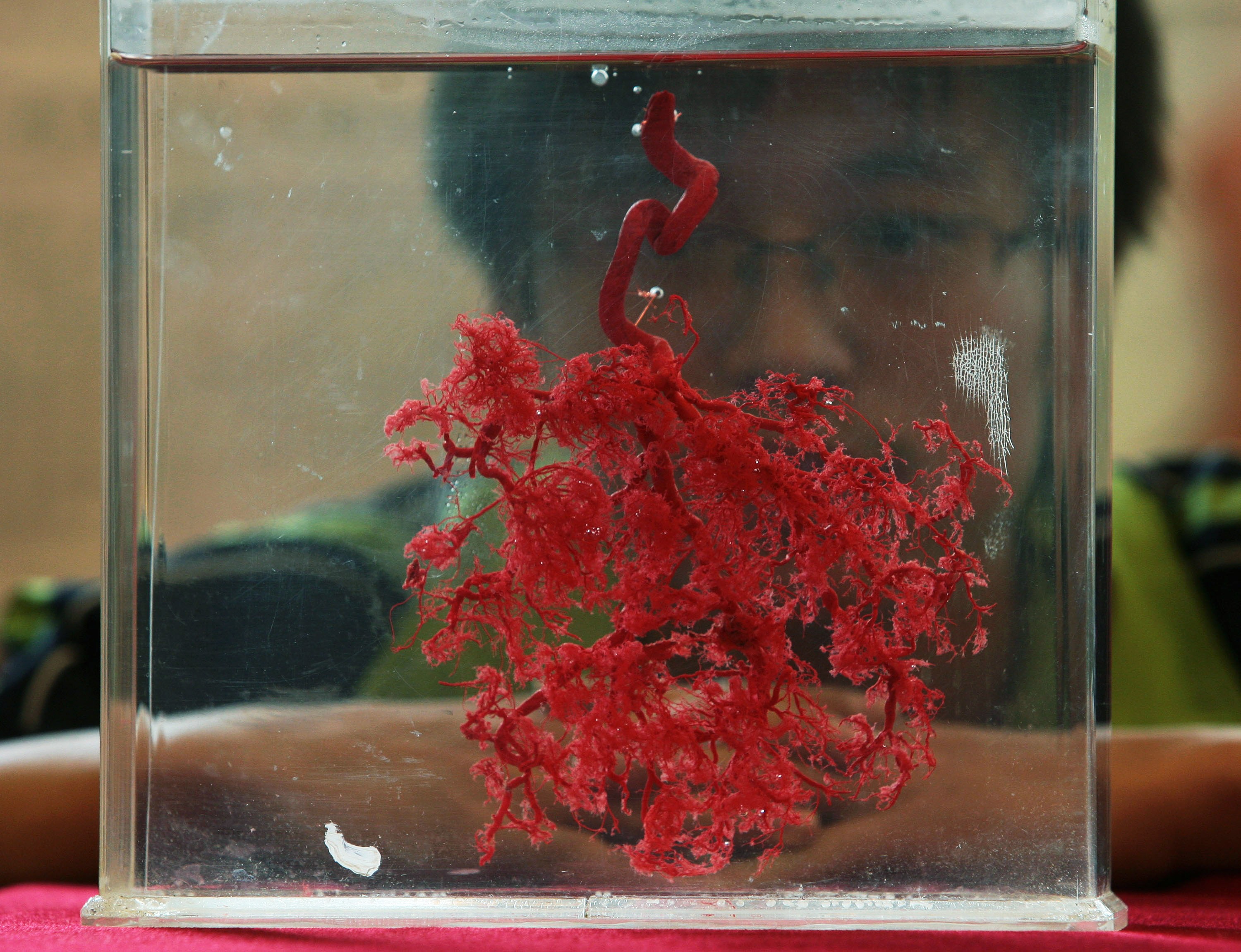 NANJING, CHINA - OCTOBER 26: (CHINA OUT) A visitor views a human specimen of placenta blood vessels during the 