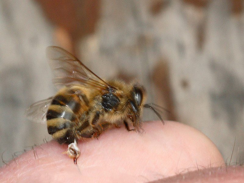 Bee sting. The stinger is torn off and left in the skin – Author: Waugsberg – CC BY-SA 3.0