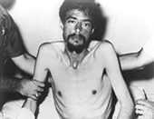 Photo taken of Dengler in the hospital after his rescue. At 5 feet nine inches (175 cm), he weighed only 98 pounds (44.45 kilos)