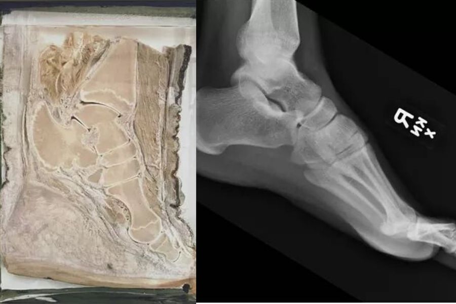 elephant and human foot comparison