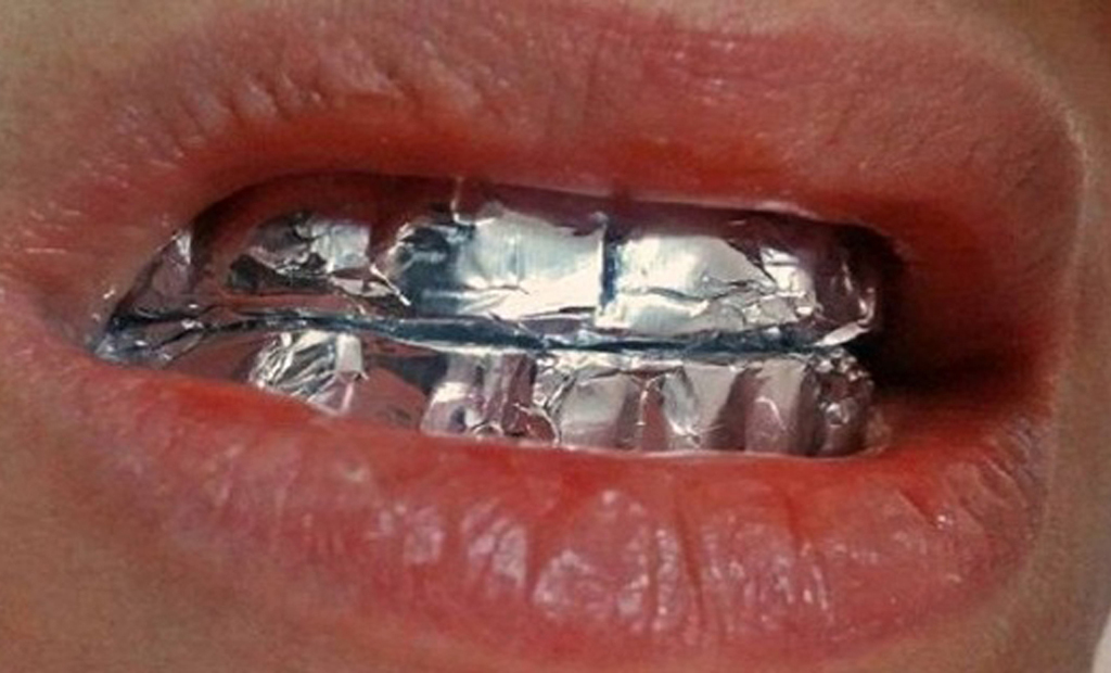 Foil wrapped around teeth 
