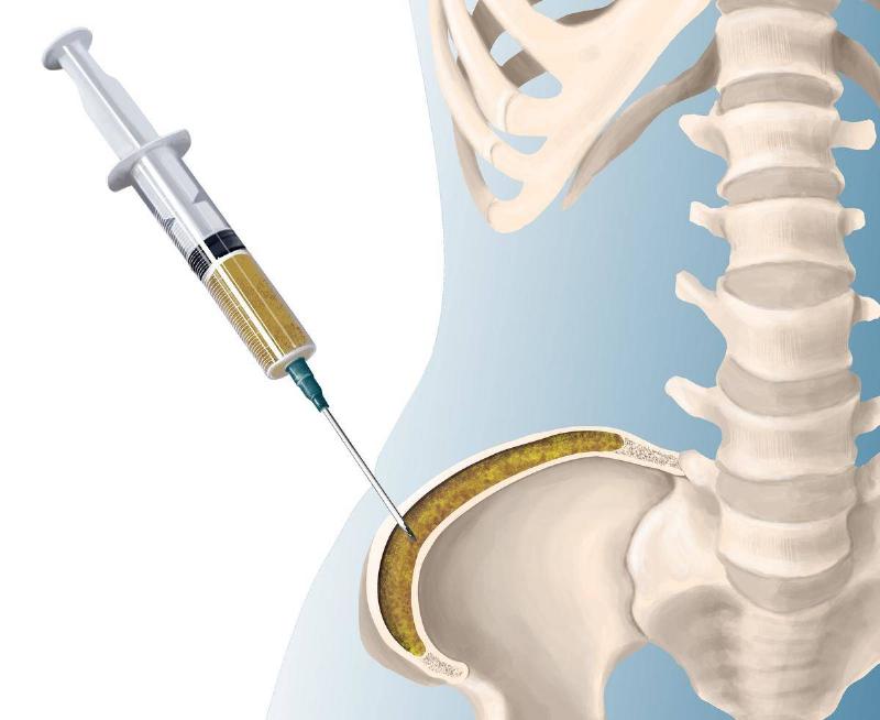 GettyImages-151049075-46087