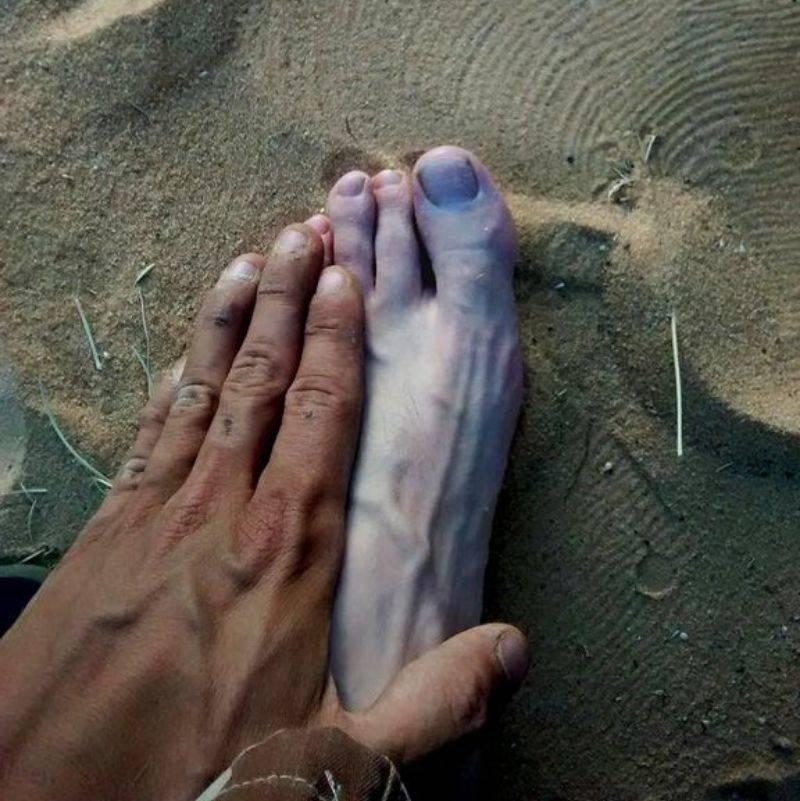 the difference between someone's tan and their skin color