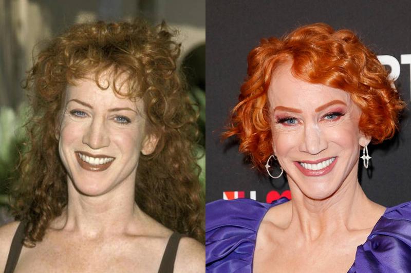 kathy-griffin-before-after-plastic-surgery