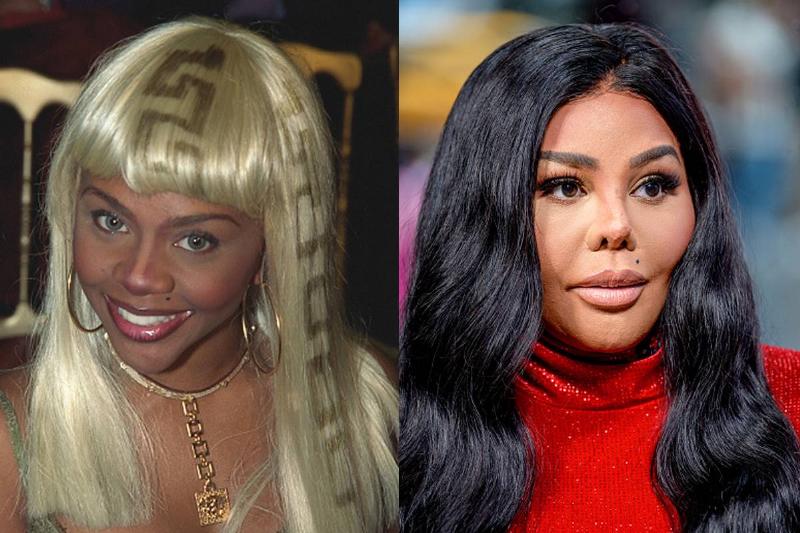 lil-k-before-after-plastic-surgery