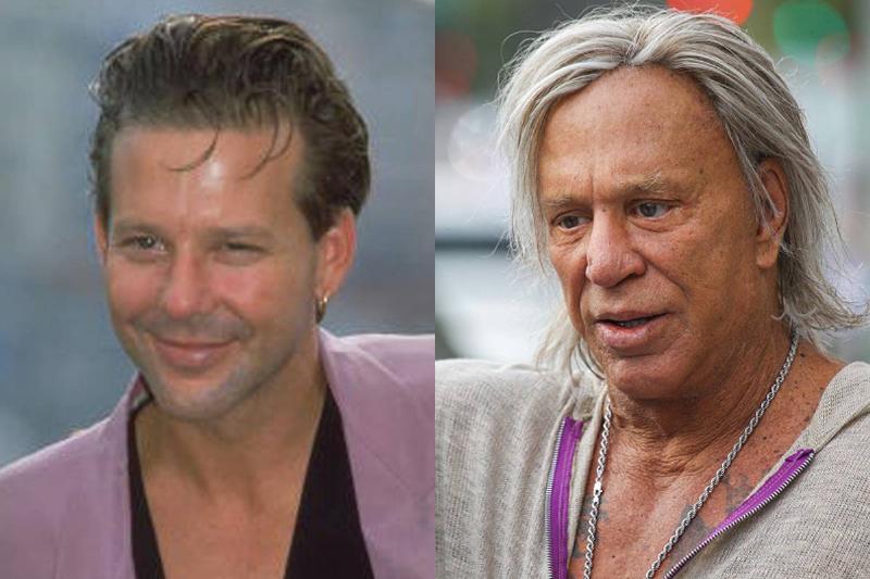 mickey-rourke-before-after-plastic-surgery