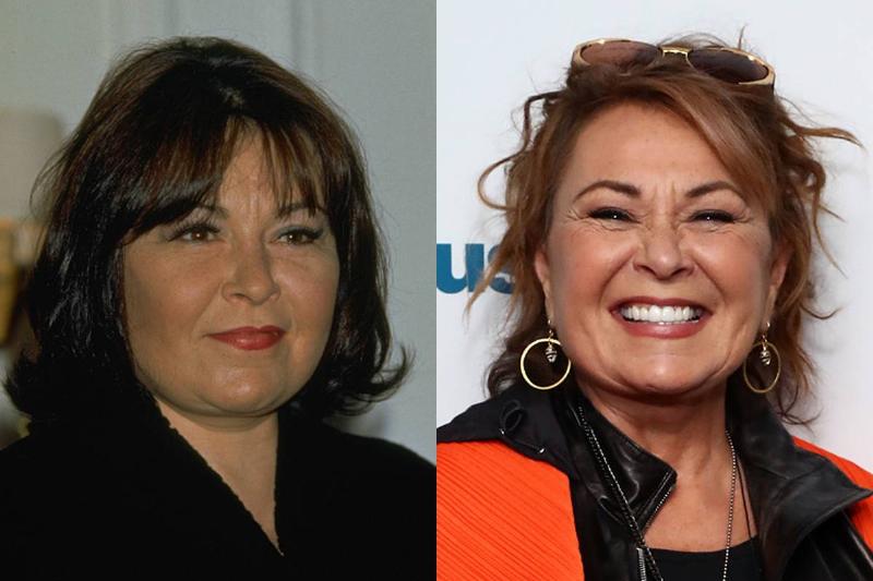 rosanne-barr-before-after-plastic-surgery