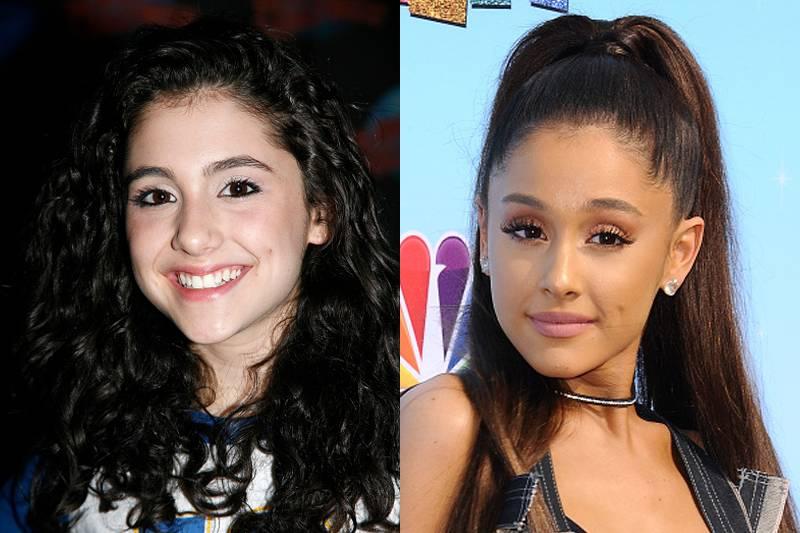 ariana-grande-plastic-surgery