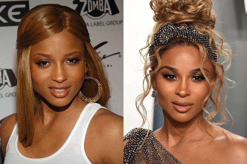 ciara-plastic-surgery