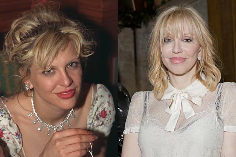 courtney-love-plastic-surgery