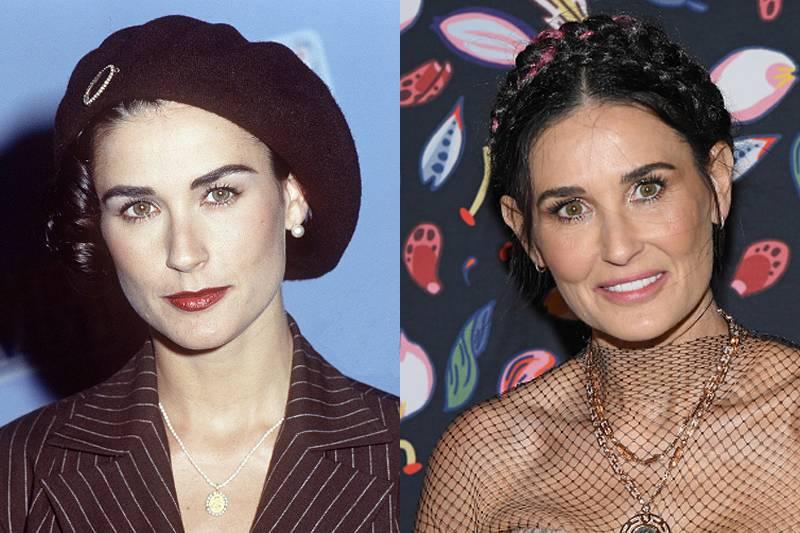 demi-moore-plastic-surgery