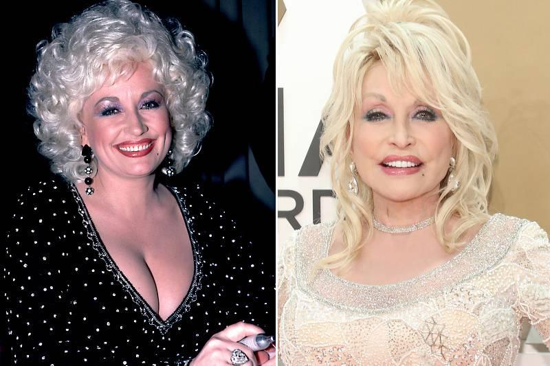 dolly-parton-plastic-surgery