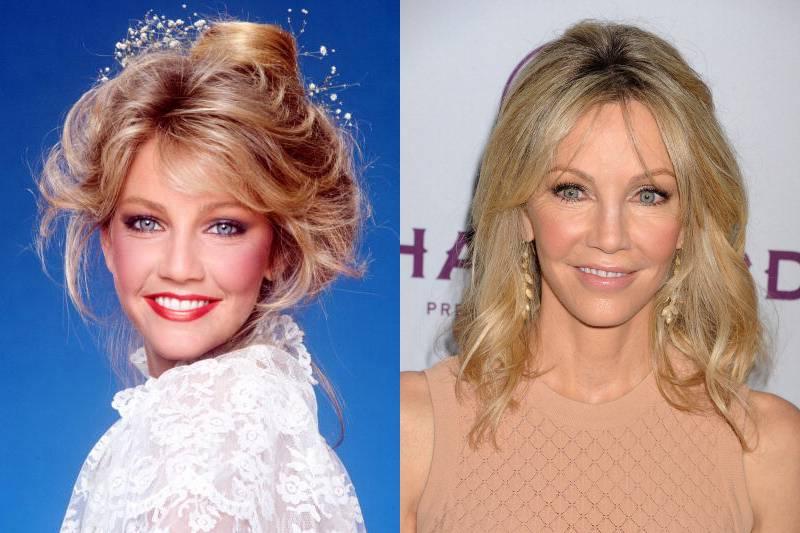 heather-locklear-plastic-surgery