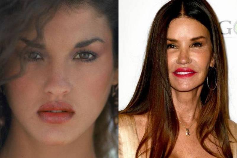 janice-dickinson-plastic-surgery