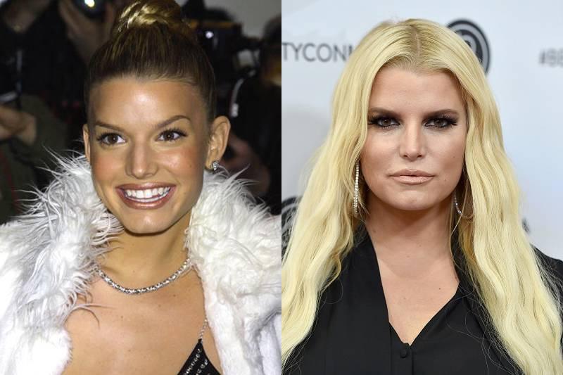 jessica-simpson-plastic-surgery