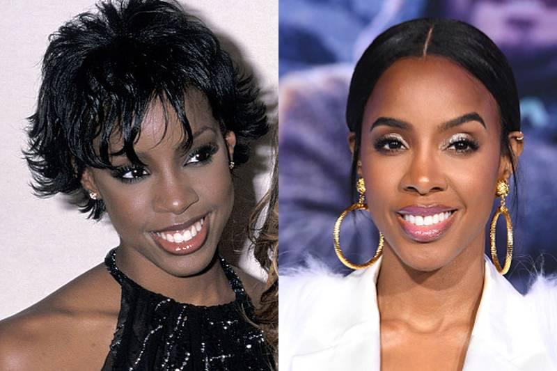 kelly-rowland-plastic-surgery