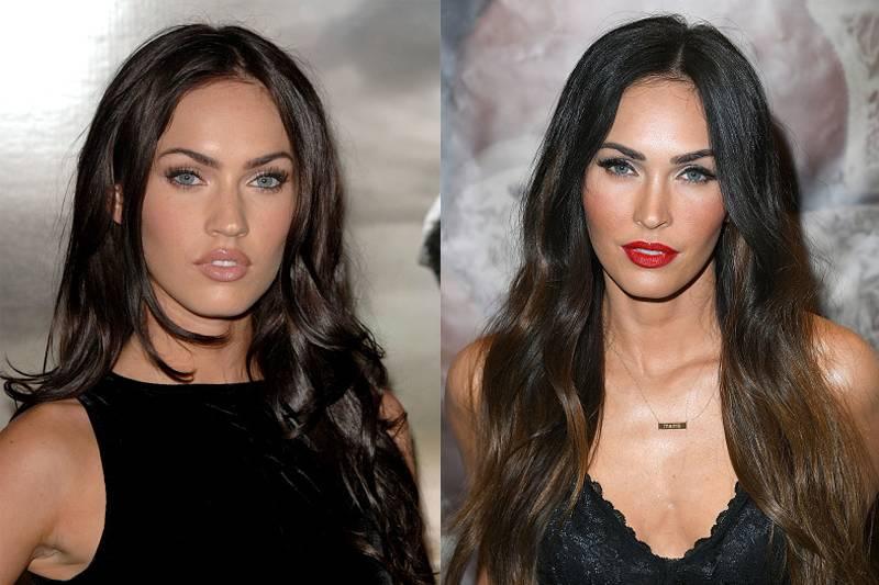 megan-fox-plastic-surgery