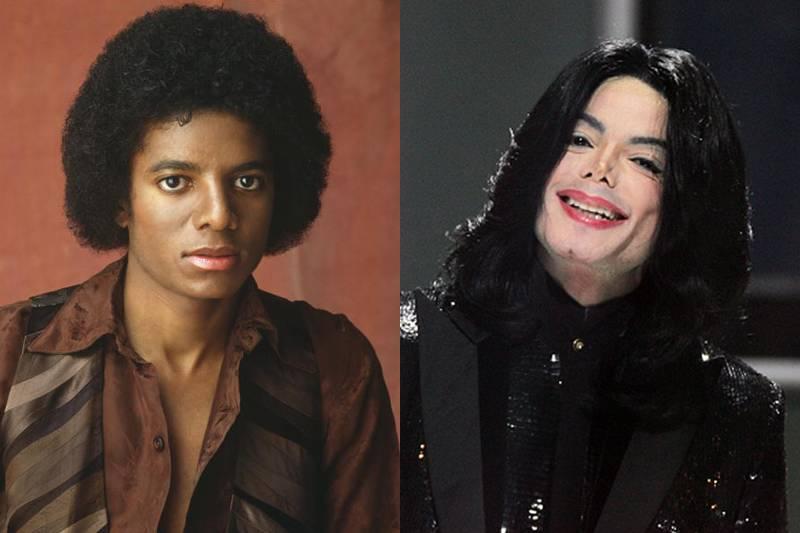 michael-jackson-plastic-surgery