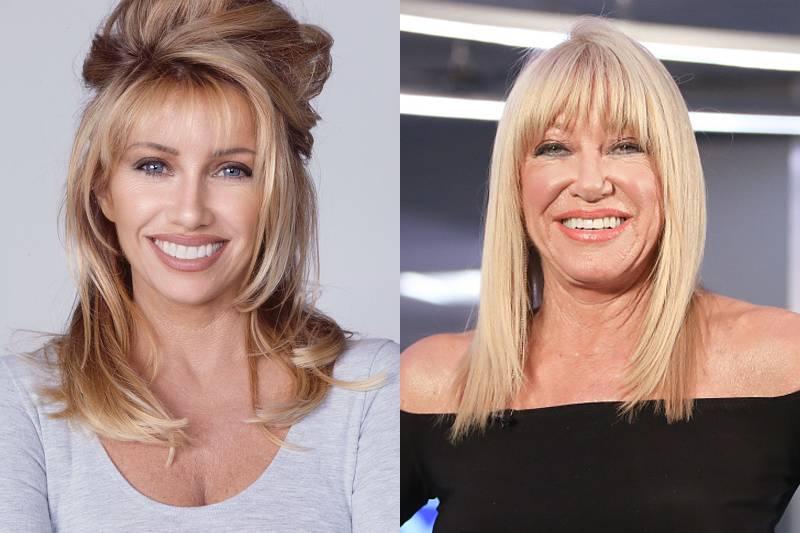 suzanne-somers-plastic-surgery