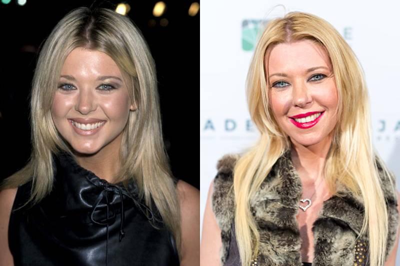 tara-reid-plastic-surgery