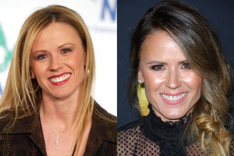 trista-sutter-plastic-surgery