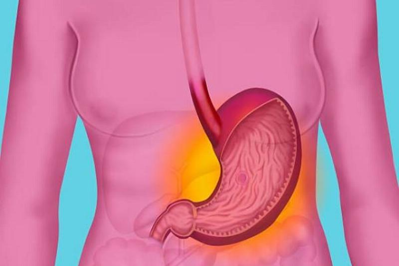 2 Flor de Jamaica 11