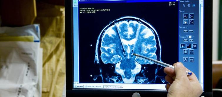 Brain Electrostimulation, Nmr
