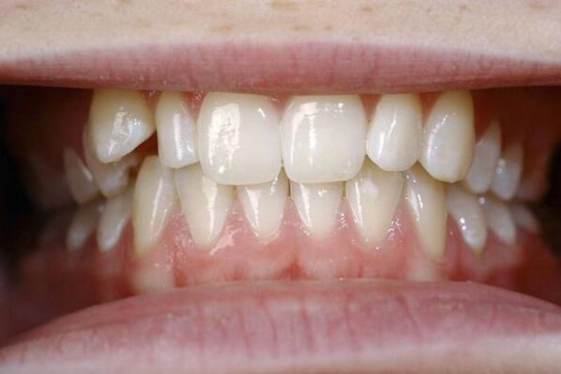 12 Renov Aloe Vera 34