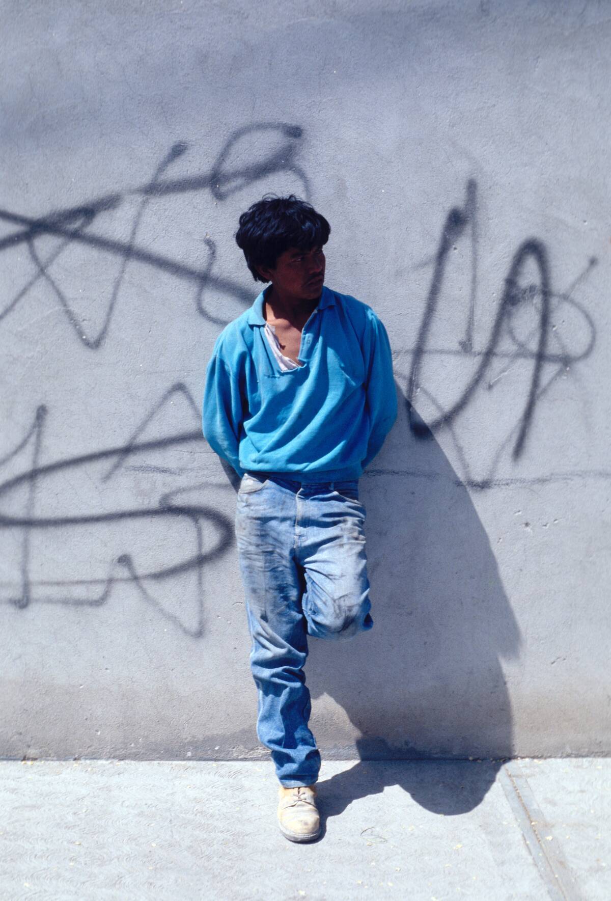 Teen Amputee In Front Of A Graffiti-Tagged Wall