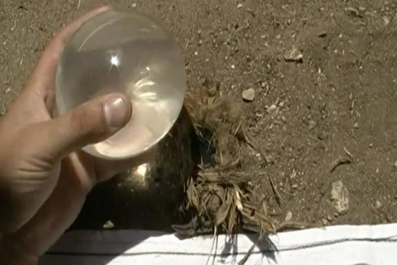 A condom filled with water being used to start a fire. 