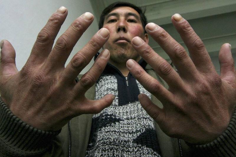 Severe Contamination Blights Kyrgyz Town