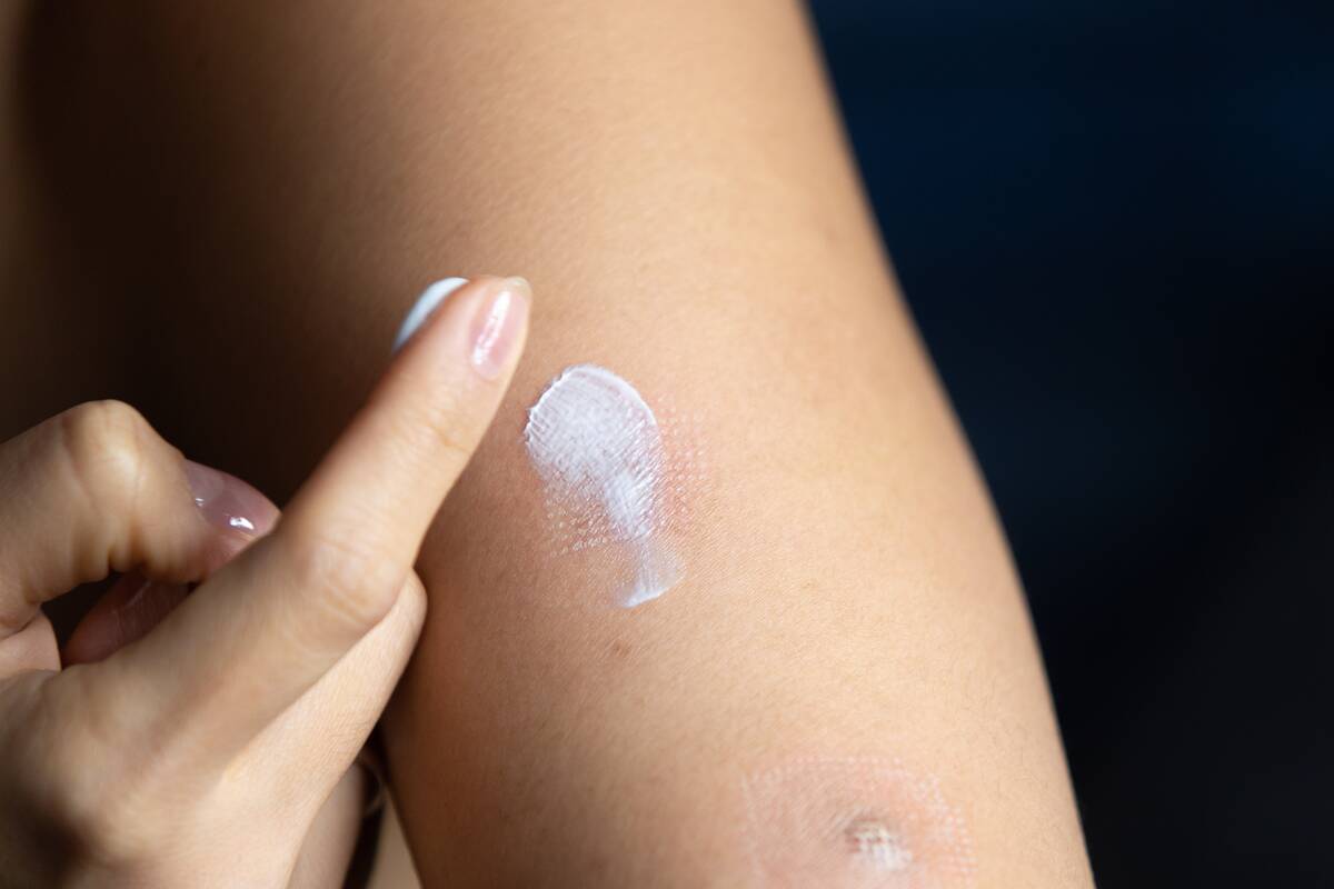 Putting creme on arm.