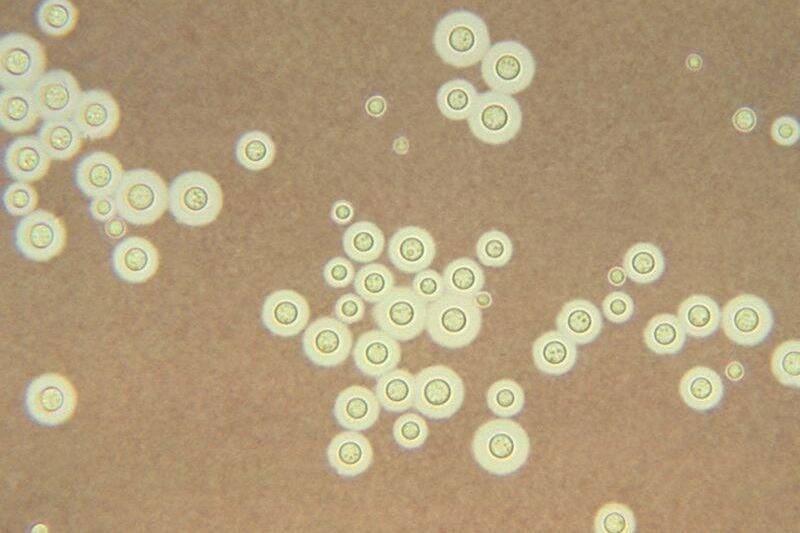 Bacteria under a microscope.