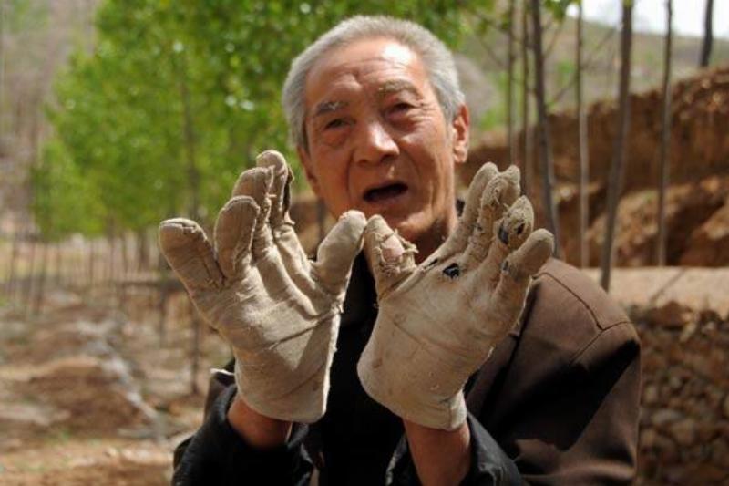 Ma Sanxiao wearing gloves.