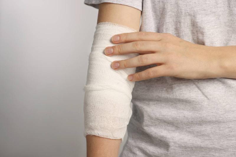 Woman with arm wrapped in medical bandage.