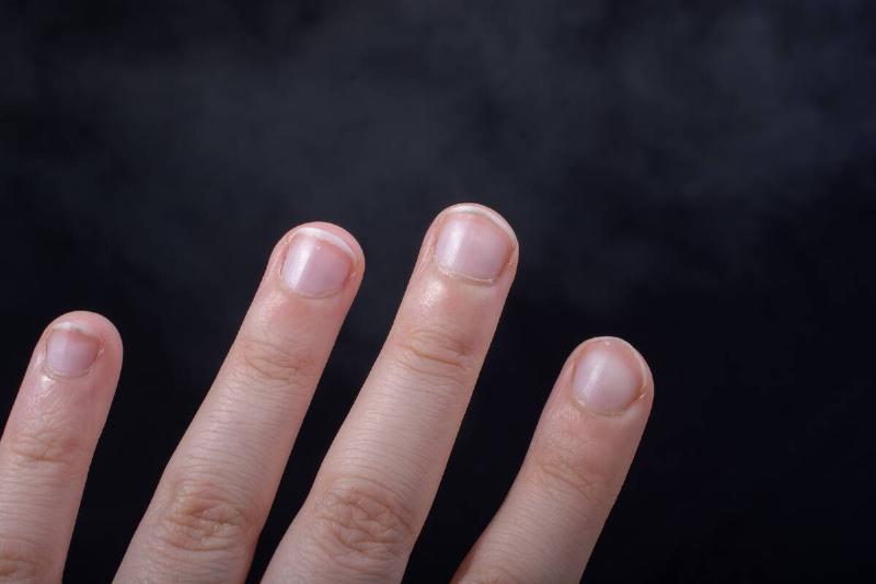 A close up of fingernails on four fingers.