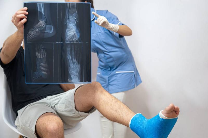 Doctor and patient looking at X-ray of broken foot. 