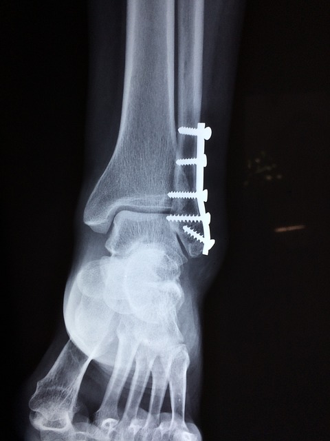ankle x-ray first aid