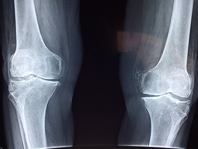 knee x-ray first aid
