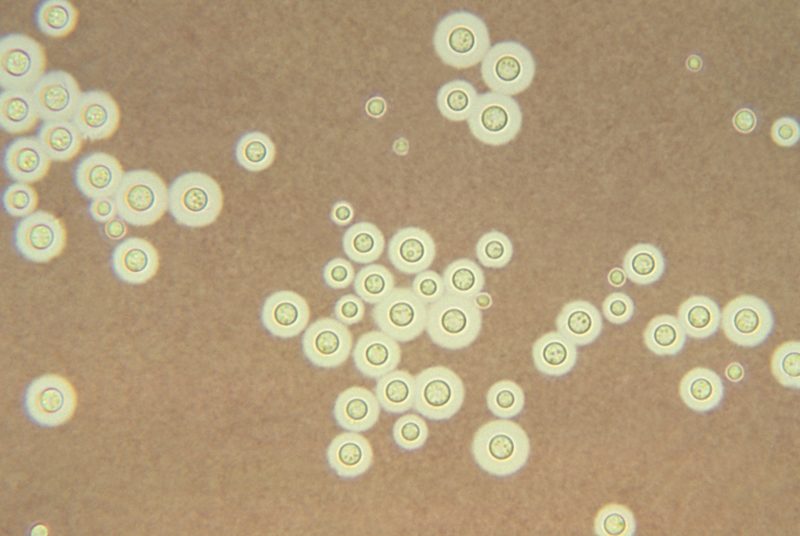 Cryptococcus neoformans, as seen through a microscope