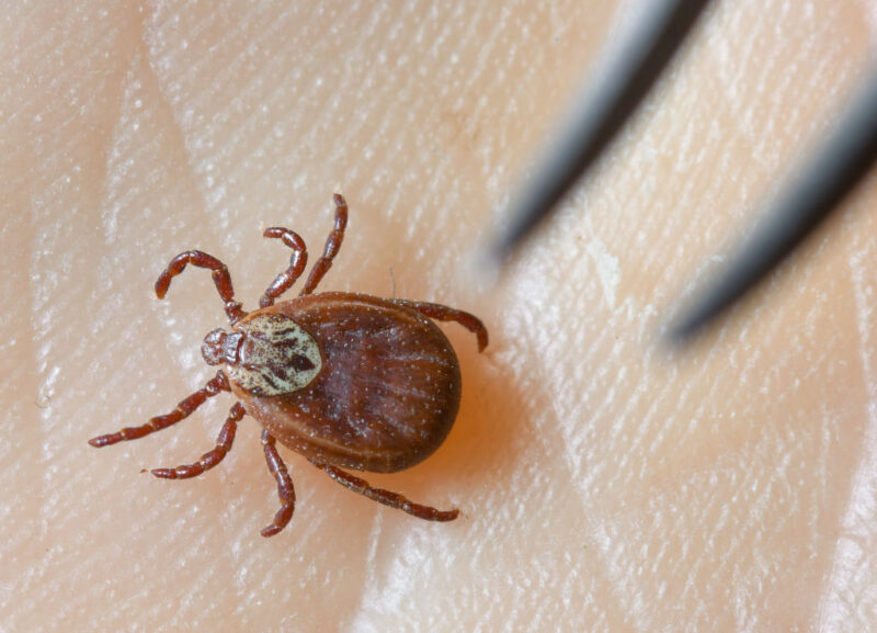 Tweezers hovering over a Common Wood tick crawling on someone's skin